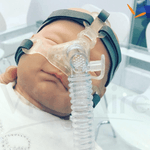 Máscara Nasal Pediátrica Respireo SOFT Baby - ALMS